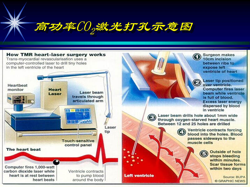 071813461818_02002-10-13激光在心血管疾病治疗中的应用_14.jpg