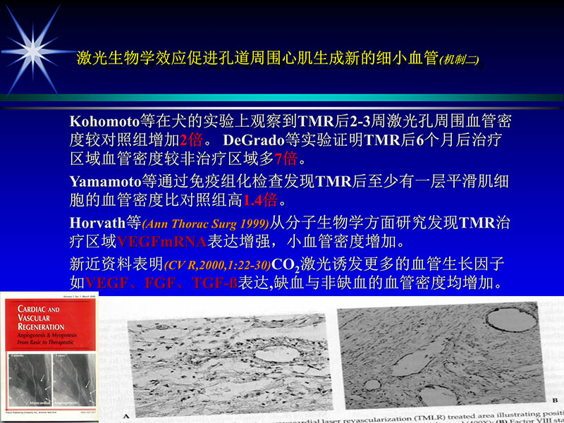 071813461818_02002-10-13激光在心血管疾病治疗中的应用_50.jpg