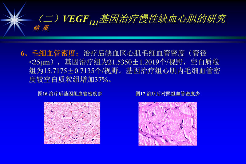 071815272322_02003-12-30vegf基因联合激光心肌血运重建的研究_26.jpg
