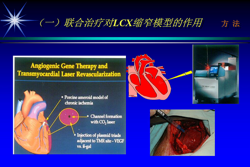 071815272322_02003-12-30vegf基因联合激光心肌血运重建的研究_30.jpg