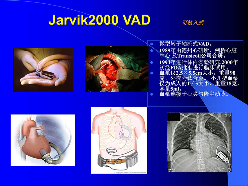 071816413472_02005-08-18现代人工心室装置治疗心衰临床应用_49.jpg