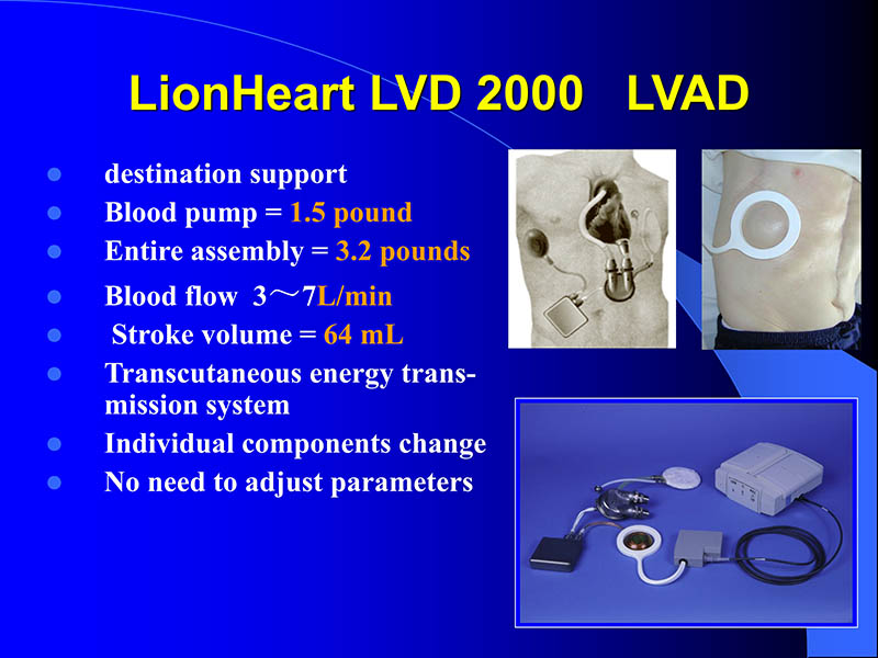 071816413472_02005-08-18现代人工心室装置治疗心衰临床应用_55.jpg