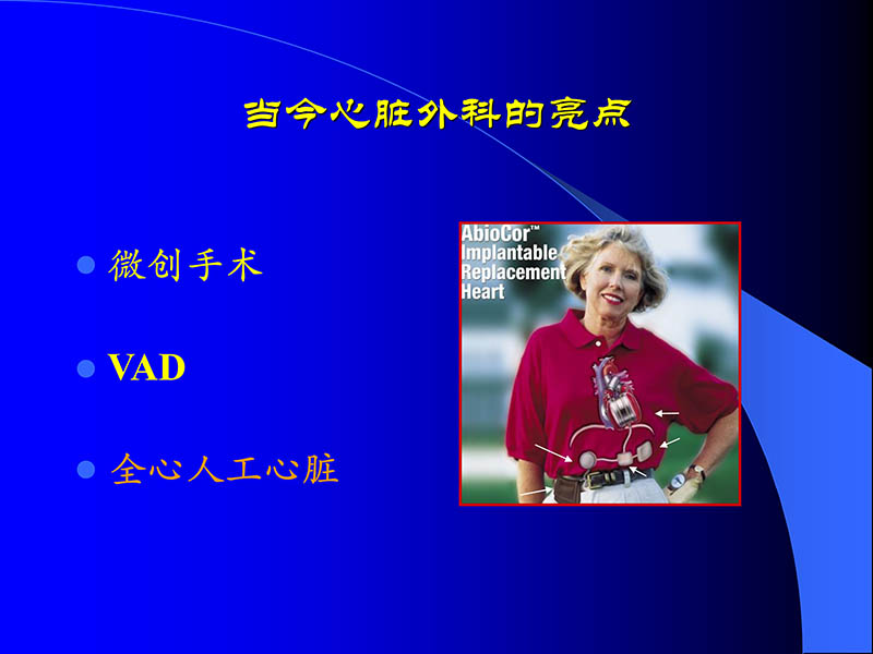072010470242_02006-03-08人工心室装置治疗心衰临床应用新概念_3.jpg