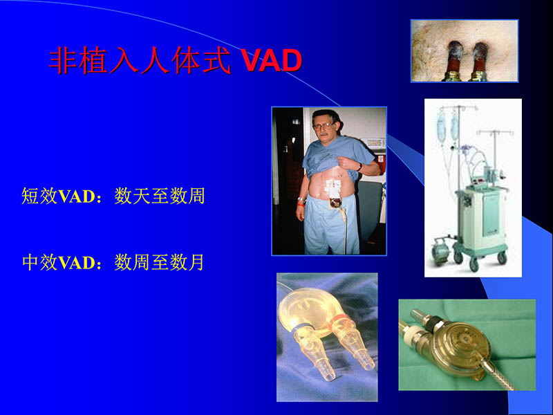 072010470242_02006-03-08人工心室装置治疗心衰临床应用新概念_6.jpg