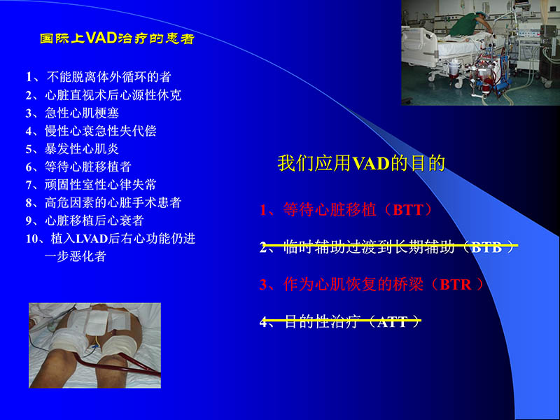 072010470242_02006-03-08人工心室装置治疗心衰临床应用新概念_39.jpg