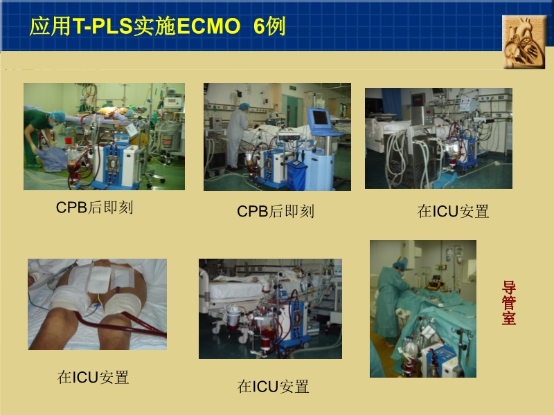 072811591096_02007-10-26中国两大心脏中心应用机械循环辅助现状_6.jpg