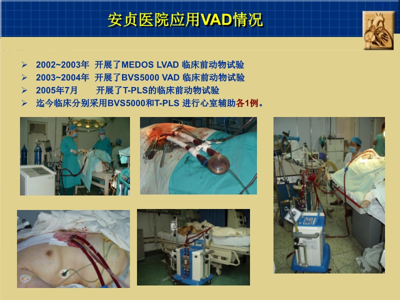 072811591096_02007-10-26中国两大心脏中心应用机械循环辅助现状_11.jpg