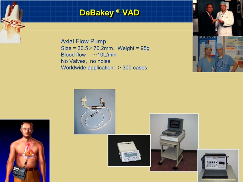 072812160890_02010-06-17心室辅助装置和人工心脏_19.jpg