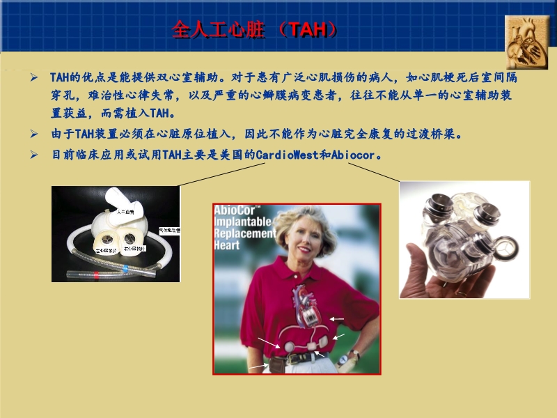 072812160890_02010-06-17心室辅助装置和人工心脏_26.jpg