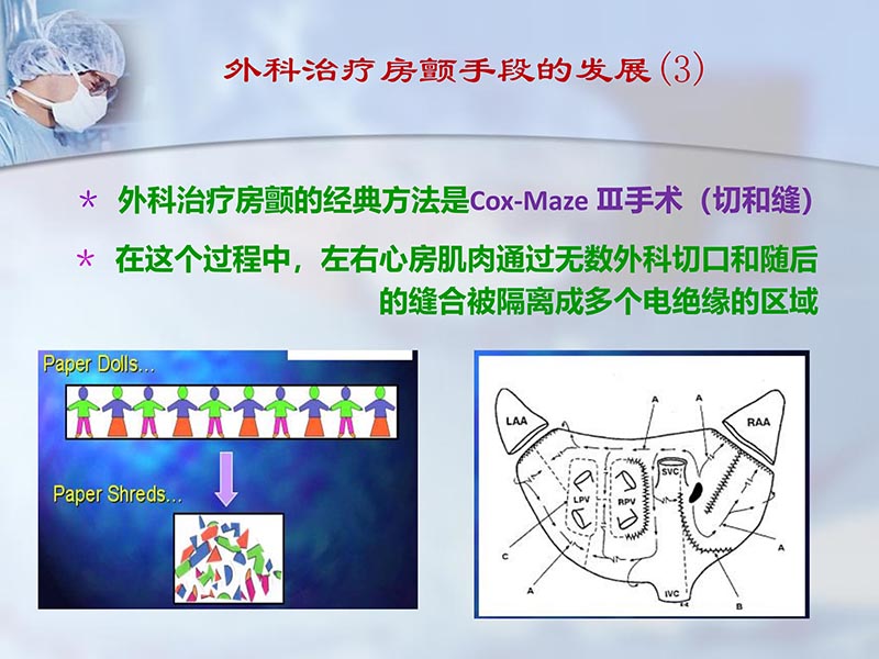 072812262445_02012-04-22微创外科治疗心房颤动_5.jpg