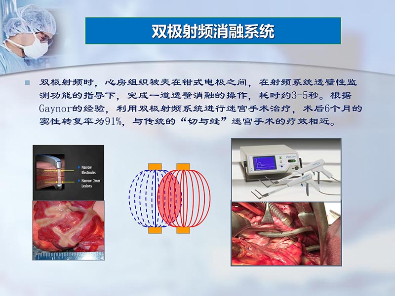 072812262445_02012-04-22微创外科治疗心房颤动_12.jpg