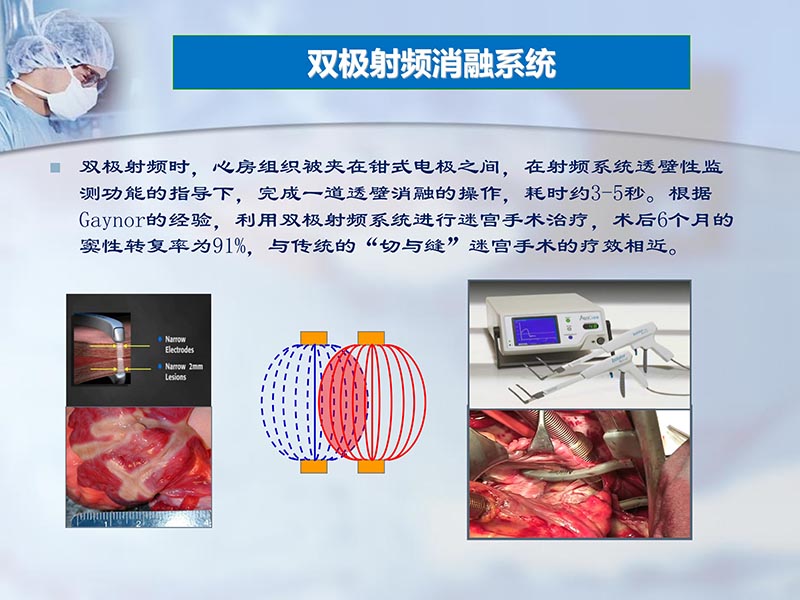 072812295126_02012-06-23外科治疗心房颤动的历史与现状_13.jpg