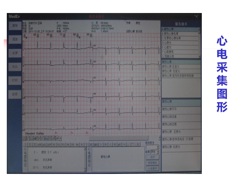 072815523744_02014-11-26了解临床心电网络诊断系统_14.jpg