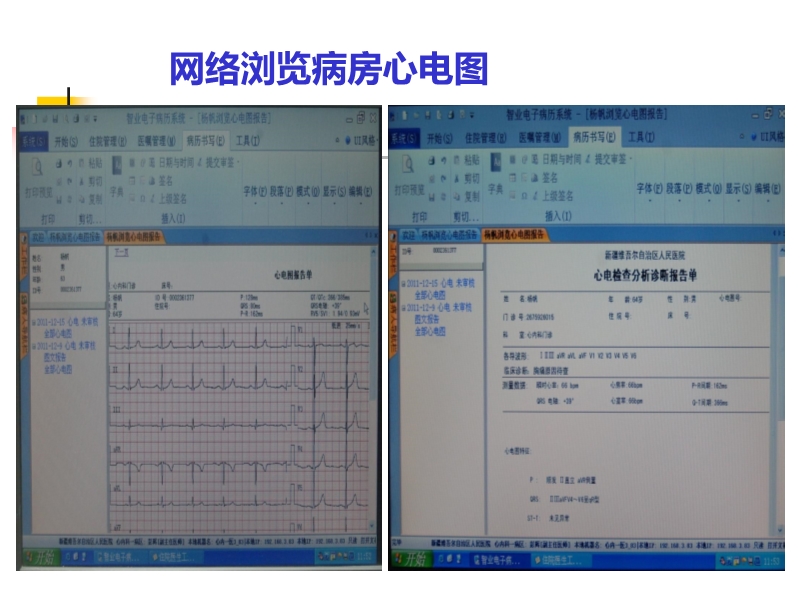072815523744_02014-11-26了解临床心电网络诊断系统_15.jpg