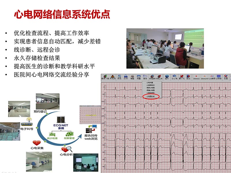 072816273117_02016-05-14云医疗心电网络系统的建设与应用_23.jpg