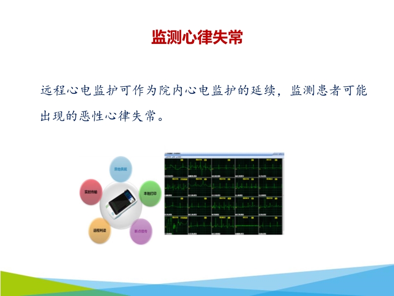 072817003843_02018-11-20远程心电监测与心脏术后康复_23.jpg