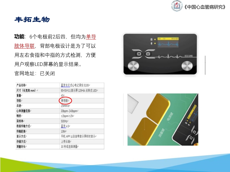 072817043318_02019-10-20可穿戴设备在心电网络中的应用与前景_18.jpg