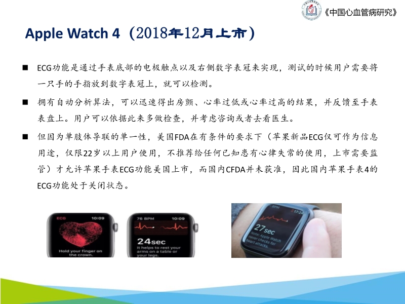 072817043318_02019-10-20可穿戴设备在心电网络中的应用与前景_24.jpg