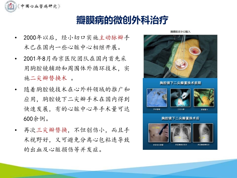 072817071574_02019-11-16中国心血管外科70年进展_15.jpg