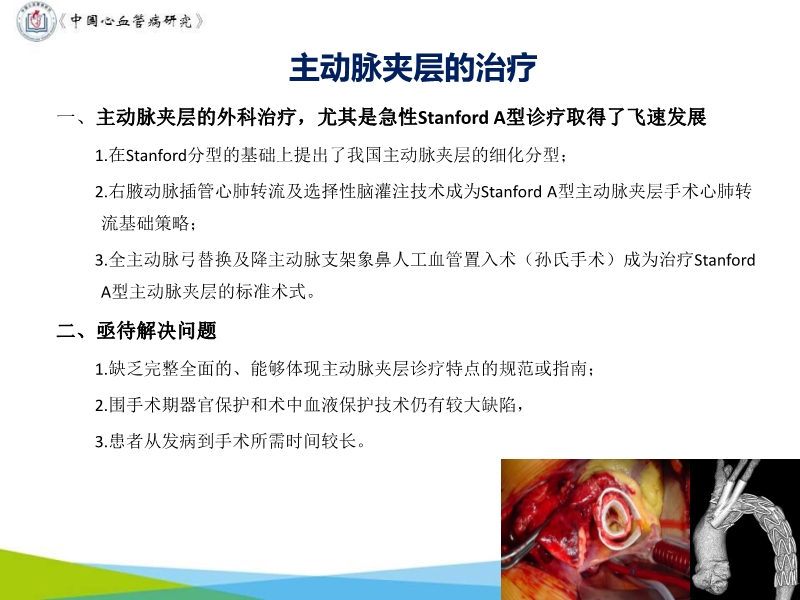 072817071574_02019-11-16中国心血管外科70年进展_18.jpg